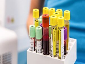 برای تشخیص اختلال سایکوسوماتیک ممکن است نیاز به آزمایش خون باشد یا حتی بدون آزمایش خون تشخیص داده شود.